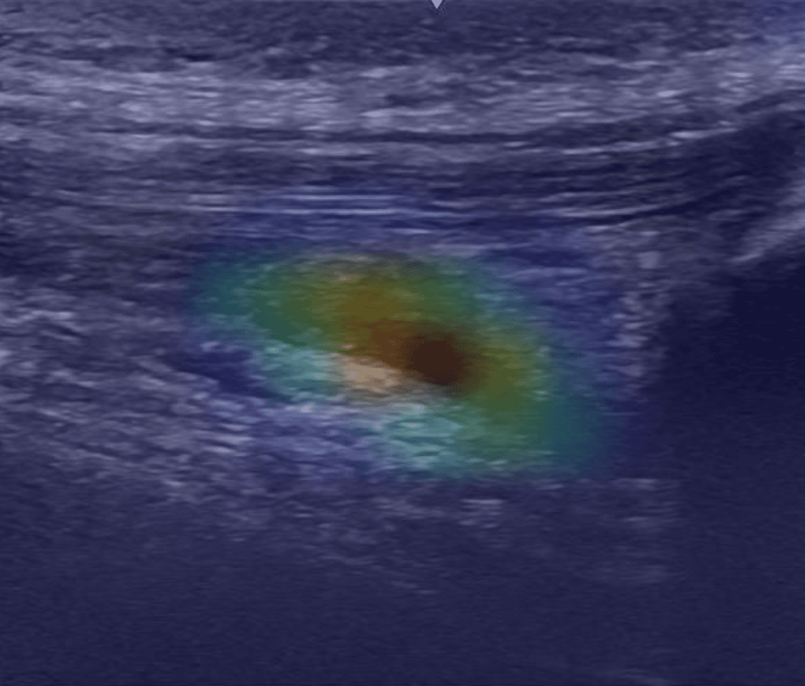 Heatmap overlay