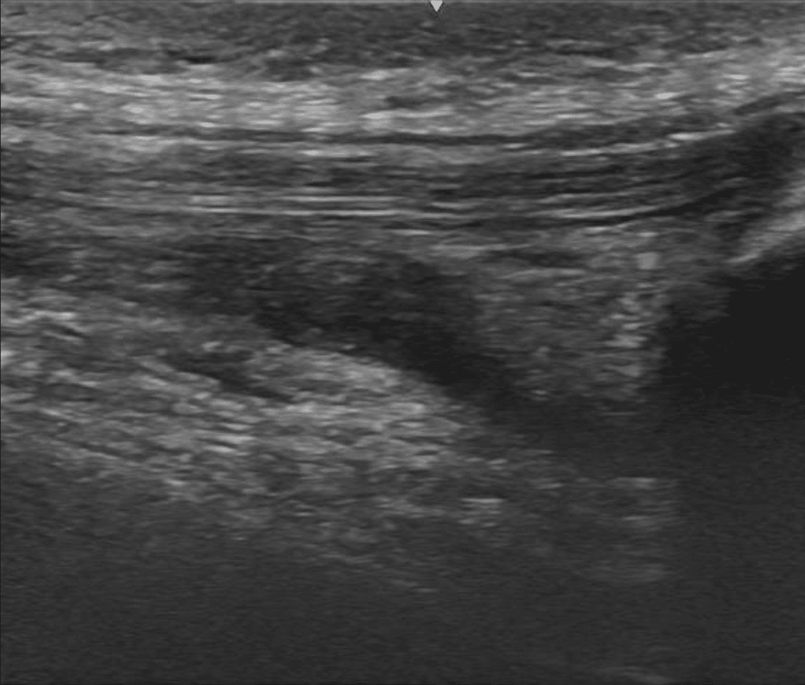 Ultrasound scan — original